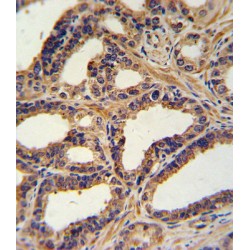 Natriuretic Peptides A (NPPA) Antibody