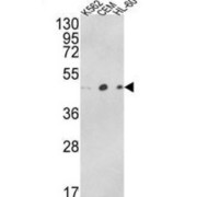 Actin-Related Protein 3B (ACTR3B) Antibody