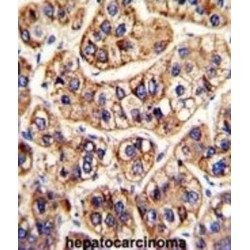 Interferon Alpha/Beta Receptor 1 (IFNAR1) Antibody
