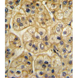 AP-2 Complex Subunit Alpha 2 (AP2A2) Antibody