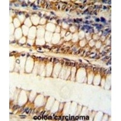 Bcl2 Like Protein 11 (BCL2L11) Antibody