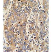 Polymeric Immunoglobulin Receptor (PIGR) Antibody