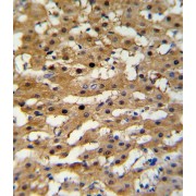 Alcohol Dehydrogenase Class-3 (ADH5) Antibody