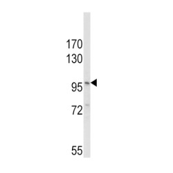 NACHT, LRR And PYD Domains-Containing Protein 3 (NLRP3) Antibody