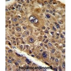 Protein Tob1 (TOB1) Antibody