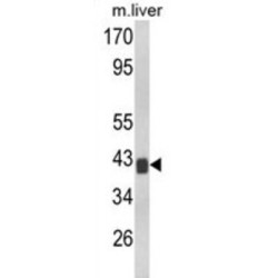 Protein Tob1 (TOB1) Antibody