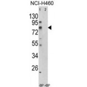 Acyl-CoA Synthetase Short-Chain Family Member 3 (ACSS3) Antibody