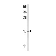 Leukotriene C4 Synthase (LTC4S) Antibody