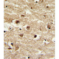 Insulin-Like Growth Factor-Binding Protein 2 (IGFBP2) Antibody