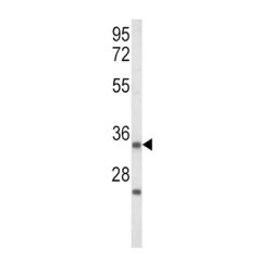 Insulin-Like Growth Factor-Binding Protein 2 (IGFBP2) Antibody