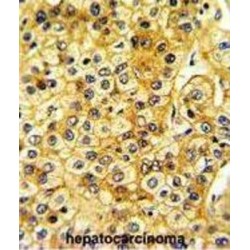 SRC Proto-Oncogene, Non-Receptor Tyrosine Kinase (SRC) Antibody