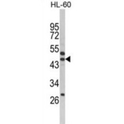 Western blot analysis of HL-60 cell line lysates using Serpin B7 (SERPINB7) Antibody.