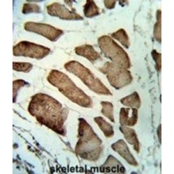 Leiomodin 1 (LMOD1) Antibody