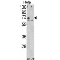 Leiomodin 1 (LMOD1) Antibody