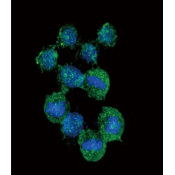 Interleukin 8 / IL8 (CXCL8) Antibody
