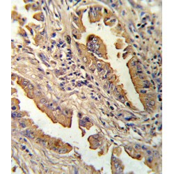 Interleukin 8 / IL8 (CXCL8) Antibody