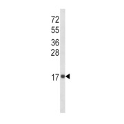 abx034024