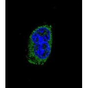 Thyrotropin Subunit Beta (TSHB) Antibody