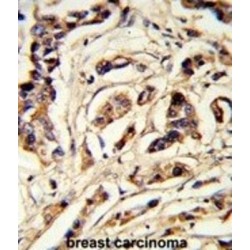 Thyrotropin Subunit Beta (TSHB) Antibody
