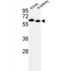 Proline Dehydrogenase 1, Mitochondrial (PRODH) Antibody
