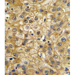 Adiponectin Receptor 1 (ADIPOR1) Antibody