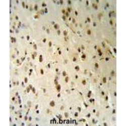 Threonyl-tRNA Synthetase Like 2 (TARSL2) Antibody