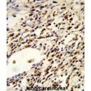 Folliculin (FLCN) Antibody