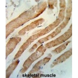 Ras-Related Protein Rab-7a (RAB7) Antibody