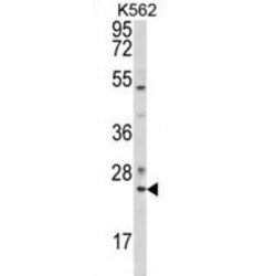 Ras-Related Protein Rab-7a (RAB7) Antibody