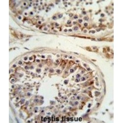 Integrin Beta III / CD61 (ITGB3) Antibody