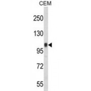 WB analysis of CEM cell line lysates (35 µg).