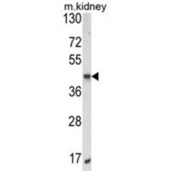 AlkB Homolog 3, Alpha-Ketoglutaratedependent Dioxygenase (ALKBH3) Antibody