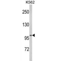Potassium-Transporting ATPase Alpha Chain 2 (ATP12A) Antibody