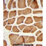 Enoyl-CoA Delta Isomerase 2 (ECI2) Antibody