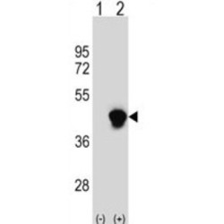 Enoyl-CoA Delta Isomerase 2 (ECI2) Antibody
