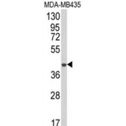 1-Acylglycerol-3-Phosphate O-Acyltransferase 4 (AGPAT4) Antibody