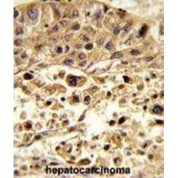 Vacuolar Protein Sorting-Associated Protein 26A (VPS26A) Antibody