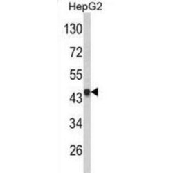 Vacuolar Protein Sorting-Associated Protein 26A (VPS26A) Antibody