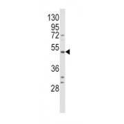 WB analysis of HepG2 cell lysates (35 µg), using BDKRB1 antibody.