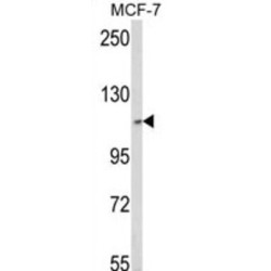 Ski2 Like RNA Helicase 2 (SKIV2L2) Antibody