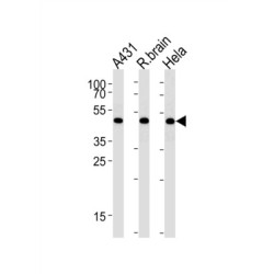 DExD-Box Helixase 39B (DDX39B) Antibody