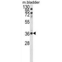Coiled-Coil Domain Containing 3 (CCDC3) Antibody