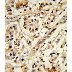 Polycomb Complex Protein BMI-1 (BMI1) Antibody