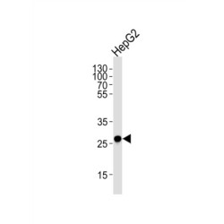 Enoyl-CoA Delta Isomerase 1, Mitochondrial (ECI1) Antibody