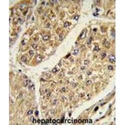 Chondroitin Sulfate N-Acetylgalactosaminyltransferase 2 (CSGALNACT2) Antibody