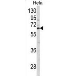 CTP Synthase 2 (CTPS2) Antibody