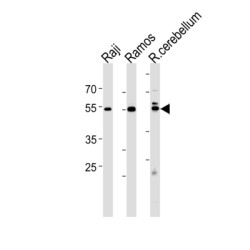 Cluster of Differentiation 24 (CD24) Antibody