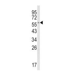 Cytochrome P450 Family 8 Subfamily B Member 1 (CYP8B1) Antibody