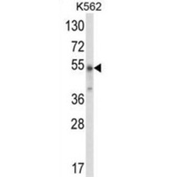 WD Repeat, SAM And U-Box Domain-Containing Protein 1 (WDSUB1) Antibody
