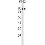 WB analysis of K562 cell line lysates (35 µg/lane), using IL1RAPL2 antibody.